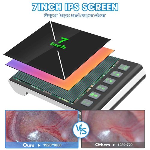 Digital Otoscope with 7 Inch IPS Screen, Hiacinto Ear Wax Removal Tool Camera, 3.9mm HD Ear Scope Otoscope with Light, Ear Camera and Wax Remover, Supports Photo Snap and Video Recording, 32GB Card