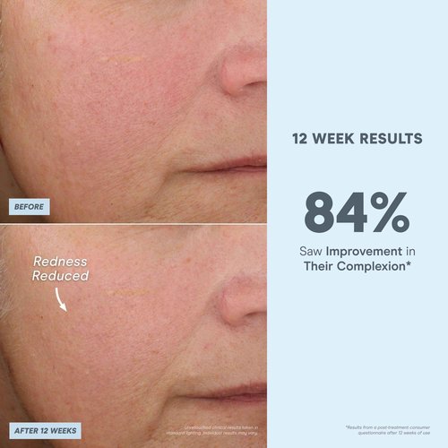 NuFACE Antioxidant Serum - Facial Firming, Smoothing & Tightening Serum to Shield and Protect Against Blue Light - Multi-Use Skincare & Super Booster for NuFACE Microcurrent Device Results (1 oz)