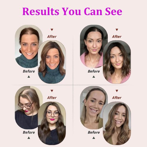 YWGYWG Hair Toppers for Women Real Human Hair, 4x4.8 Inch Upgrade Basement 360° Cover 3D Clip in Hairpieces for Women with Thinning hair, 14 Inch 2# Dark Brown