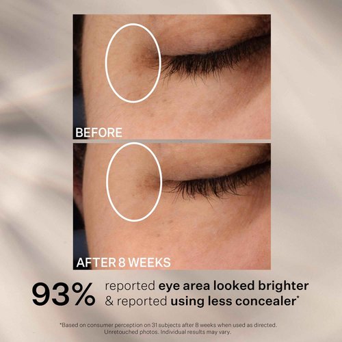 StriVectin Super C Dark Circle Brightening Eye Serum, 0.5 oz