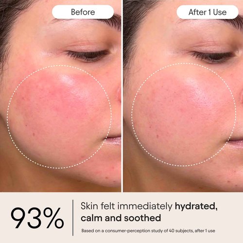 Alpyn Super Peptide & Ghostberry Moisturizer for Eczema, Barrier & Wrinkle Repair | Calm & Soothe Against Redness & Irritation | 1.7 oz / 50 ml