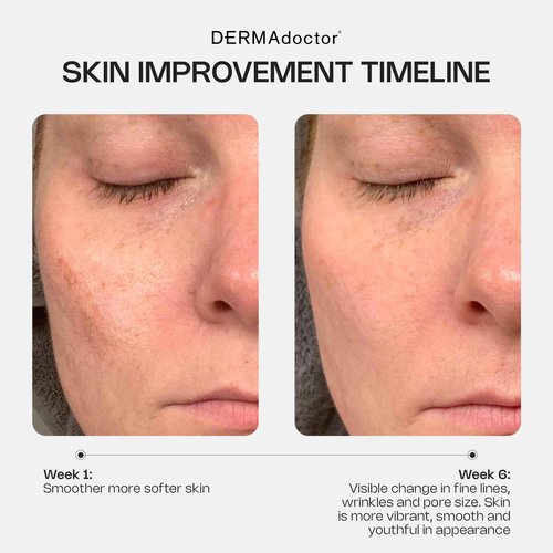 DERMAdoctor Retinol Cream for Face - Stabilized Vitamin C, Vitamin E, Ferulic Acid Anti Aging Face Cream 1% Retinol Facial Moisturizer Night-Cream for Dullness, Discoloration, Fine Lines, & Wrinkles