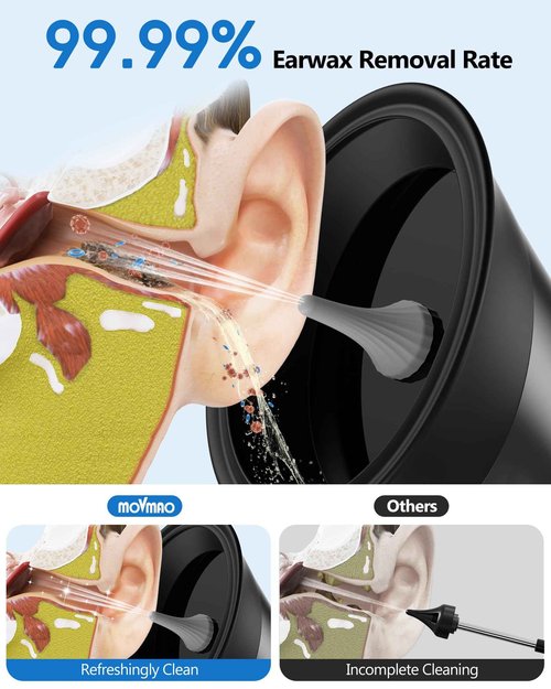 Electric Ear Cleaner with LED Display & 12 Tips – Gentle, Effective & Built to Last, Safe Ear Wax Removal Kit for Adults and Kids