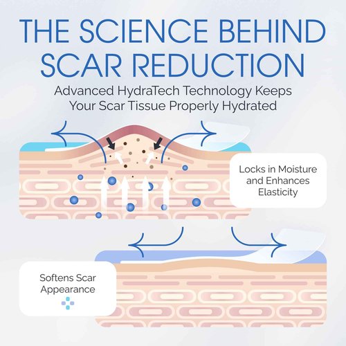 Medical Grade Silicone Scar Sheets - Long Water-Resistant Silicone Scar Tape - Advanced Solution for Surgical Scars, Stretch Marks, and Keloids - 7-Inch Strips, 12-Pack