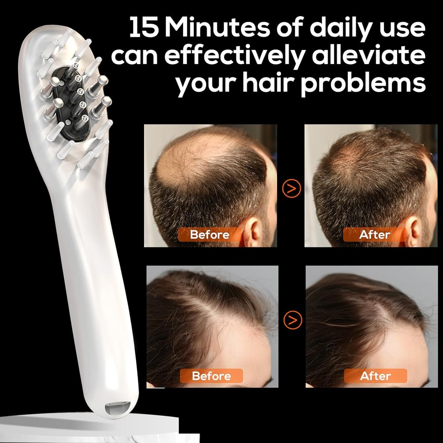 Laser Therapy Hair Growth Comb,Model: Lasercomb-001, Promote Hair Growth in Women and Men,Laser Comb is a Hand-Held Comb-Shaped Low Level Laser Therapy Device