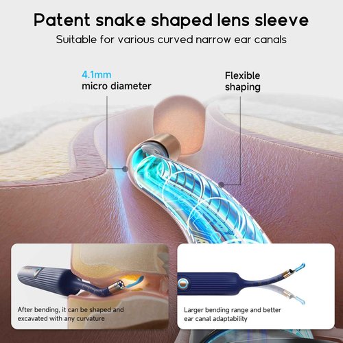 Ear Wax Removal Tool Camera, BEBIRD Visual Earwax Cleaner with Cleaning Kit as Spade/Spoon/Pick/Tweezer Clean Ears for Family, Ear-Scope Otoscope Wireless WiFi Connect