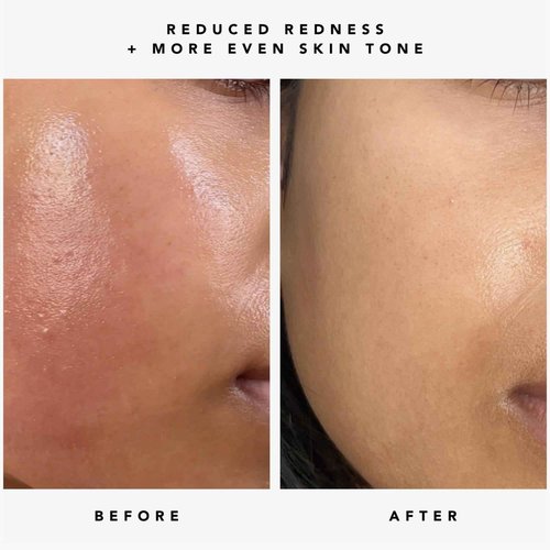 HERBIVORE Nova 15% Vitamin C + Turmeric Brightening Serum for Dark Spots, Hyperpigmentation + Even Skin Tone | Vegan, Plant-Based, Cruelty-Free, 30 mL / 1 oz