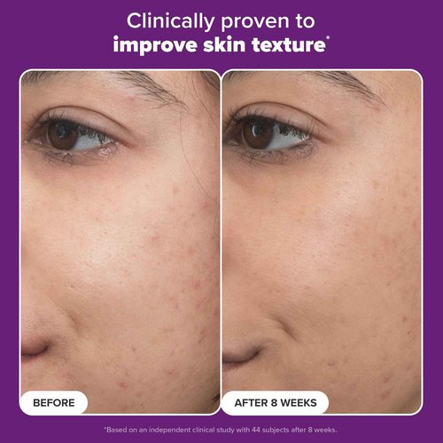 Paula’s Choice Pro Retinaldehyde Dual-Retinoid Face Serum Advanced Treatment, High Potency Anti-Aging Serum for Face, Breakout-Prone Skin, Radiance & Rough, Bumpy Texture, Fragrance-Free, 1 fl oz