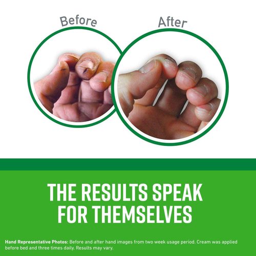 O'Keeffe's K0680001-5 Working Hands Hand Cream in Jar (5 Pack), 6.8 oz