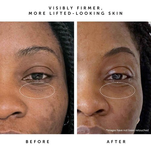 HERBIVORE Bakuchiol Retinol Alternative Moon Fruit Face Serum EXTRA STRENGTH – 1% Bakuchiol + Peptides, Smooths Skin, Reduces Fine Lines & Wrinkles, Plant-based, Vegan, Cruelty-free, 30mL / 1 oz