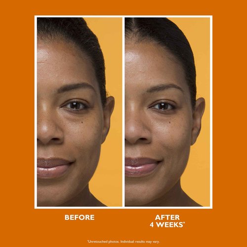Peter Thomas Roth | Potent-C Brightening Vitamin C Moisturizer