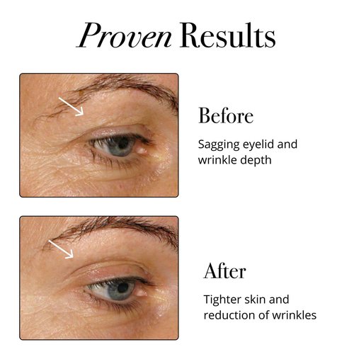 Glotrition Super Beauty Elixir - Collagen Peptides Powder for Skin, Hair & Nail Health. Natural Grass Fed Collagen with Biotin, Hyaluronic Acid & Antioxidants (30ct)