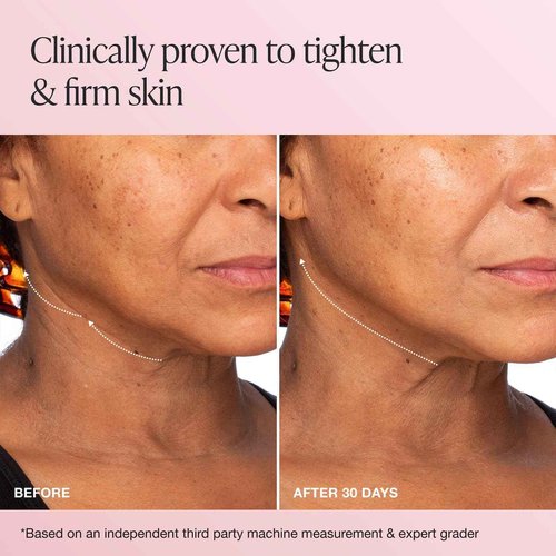 Innbeauty Project Extreme Cream Anti-Aging, Firming & Lifting Moisturizer 1.7 oz