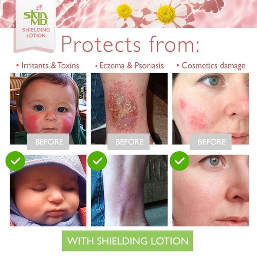 Skin MD Shielding Lotion 4oz - 3 Pack Hydrating Body Lotion for Sensitive Skin with Dispenser | Non-Greasy, Fast-Absorbing Moisturizer with Plant-Based Ingredients, Eczema & Psoriasis Relief