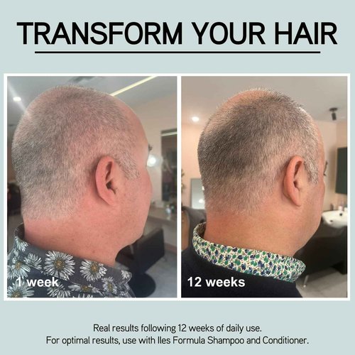 ILES FORMULA Grey Delay Anti Gray Hair Booster – Botanical Leave-In Treatment Spray with Silverfree and Melanogray to Restore Natural Hair Color and Prevent Premature Greying, 1-Month Supply