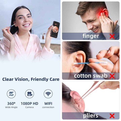 MARSDREAMS Ear Wax Removal Tool with Tweezers, Ear Cleaner with FHD Camera, Cleaning Earwax Remover Picker Kit with Light 12 Replacement Ear Picks