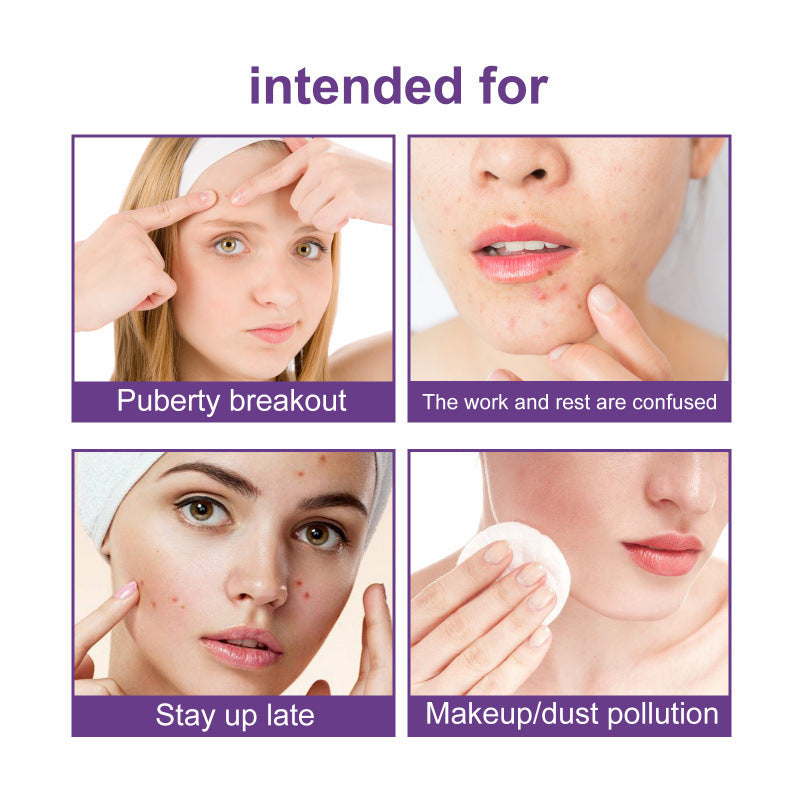 Waterproof Breathable Acne Patch Set - 180 Patches for Skin Repair