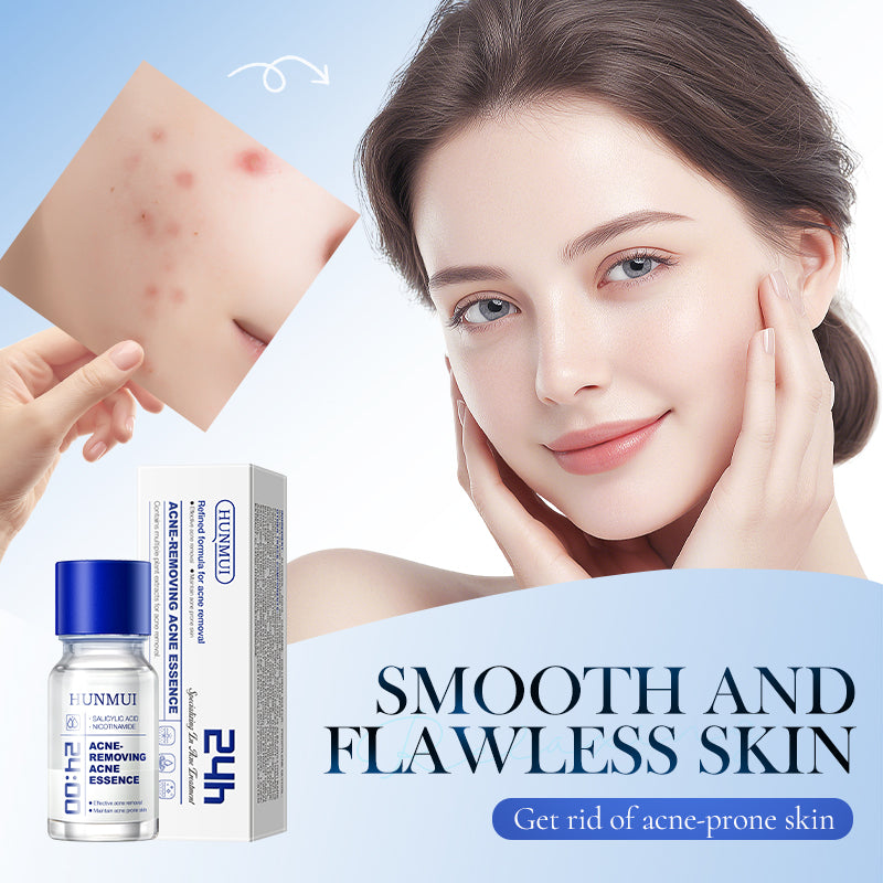 Acne Spot Treatment Serum - 10ml Oil Control & Anti-Inflammatory Skin Care