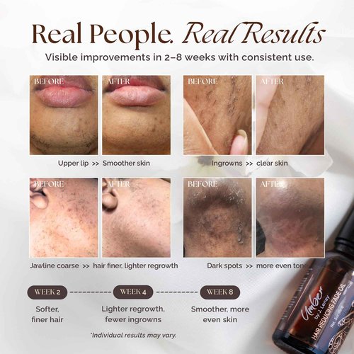 Umber By J. Lenay Hair Reducing Fade Oil 15ml – Facial Hair Reducing for Women & Men – Natural Hair Reduction Oil for Face & Body - Helps with Ingrown Hairs– Regular Strength (Not for Sensitive Skin)