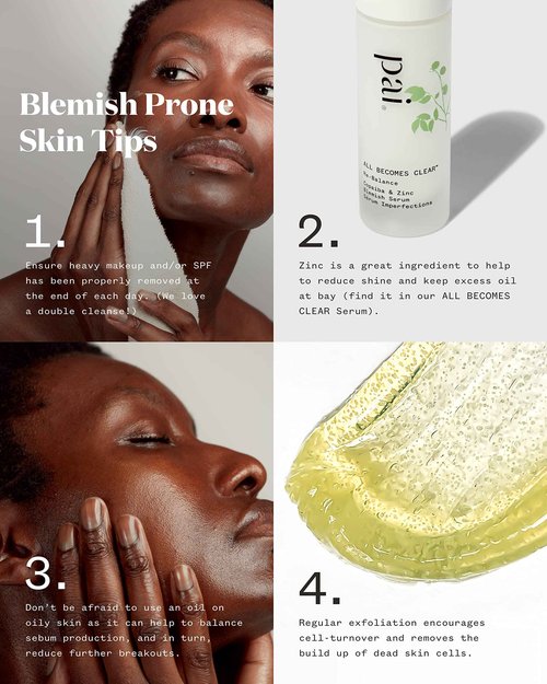 Pai Skincare - All Becomes Clear: Organic Copaiba + Zinc Blemish Serum | Natural, Vegan, Sensitive Skincare (1 fl oz | 30 mL)