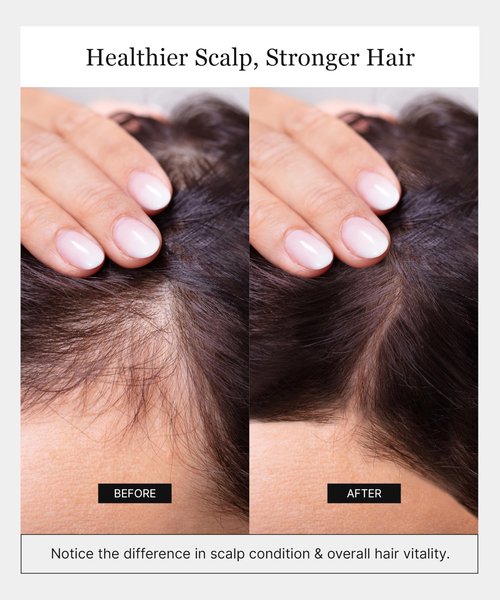 Keracell Invigorating Shampoo - Hair Growth Shampoo for Women & Men with Human Stem Cell Extract – Cleanses, Strengthens & Moisturizes to Support a Healthier Scalp & Fuller-Looking Hair - 8 oz