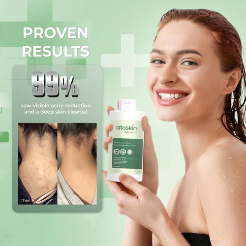 Atoskin Derma Shower (3 Pack) – Herbal Body Cleanser for Oily & Acne-Prone Skin, with Rosemary & 7 Botanical Extracts (28.41 oz)