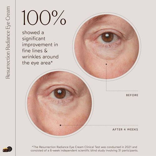 True Botanicals Resurrection Radiance Brightening Eye Cream | Reduces Appearance of Dark Circles, Fine Lines, Wrinkles & Puffiness | Dermatologist Tested, All Natural, Vegan| 0.5 oz | 15 ml