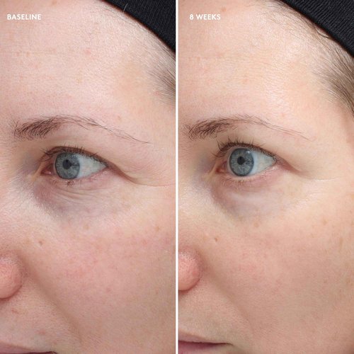 Colorescience Total Eye Firm & Repair Cream, .6 fl. oz.