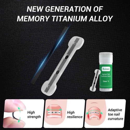 Reieset Titanium Alloy Ingrown Toenail Treatment, Nail Tools, and Ingrown Toenail Removal Kit Specially Designed for Curved Nail Repair and Ingrown Toenail Corrector (0.67/0.79in)