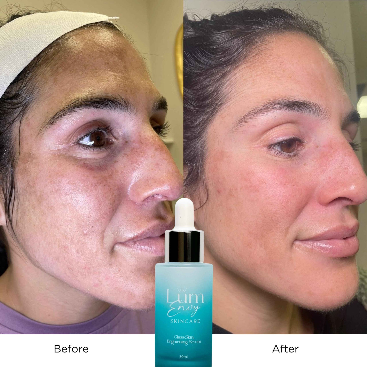 LumEnvy Salmon DNA Glass Skin Serum - Hydrating Korean Skincare Face Serum with PDRN, Niacinamide & Centella Asiatica | Brightening, Dry Skin, Anti-Aging, Dark Spots & Wrinkles | 30ml