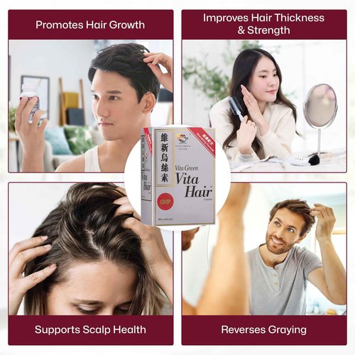 Vita Green Hair Growth Supplement (維新烏絲素) – Herbal Support for Thinning and Graying Hair – Naturally Simulates Follicles to Encourage Fuller, Healthier Hair – 90 Capsules