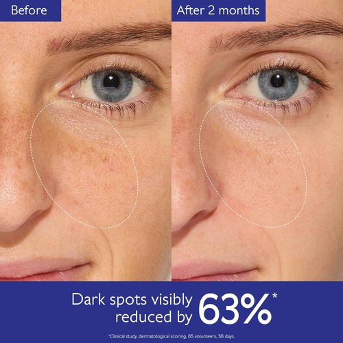 Caudalie Vinoperfect Brightening Dark Spot Serum Vitamin C Alternative - 62x More Effective than Vitamin C with Viniferine for a Visibly Brighter Even Complexion, 30 mL