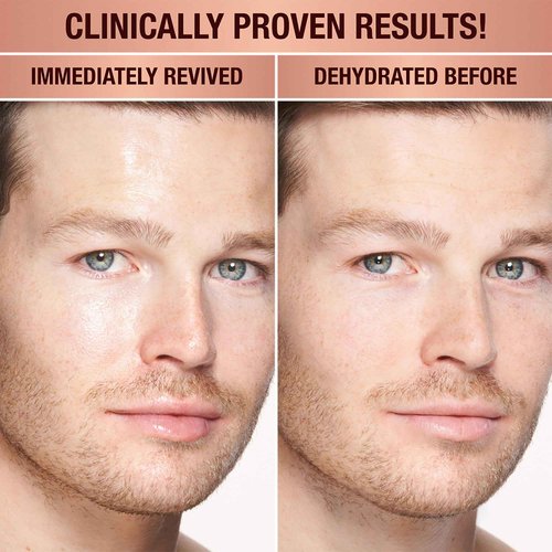 Charlotte Tilbury Magic Water Face Cream - Lightweight, Dewy Gel Moisturizer for Sensitive Skin - Infused with Niacinamide & Biopeptide Complex to Help Improve Appearance of Fine Lines (30ml)