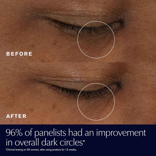 Estée Lauder Advanced Night Repair Eye Supercharged Gel-Cream Synchronized Multi-Recovery | Under Eye Cream for Dark Circles, 0.5 Fl Oz