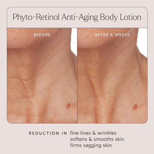 True Botanicals Phyto Retinol Sleep Serum | Nightly Anti-Aging Serum | Retinol Alternative | Targets & Reduces Fine Lines & Wrinkles | Dermatologist Tested, All Natural, Vegan | 1 fl oz | 30 ml