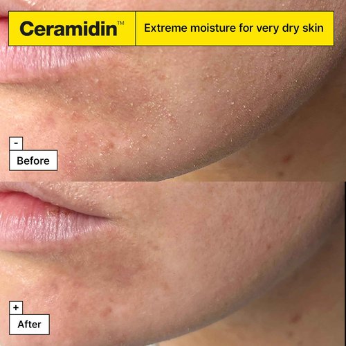 Dr.Jart+ Ceramidin Ectoin-Infused Korean Face Cream Moisturizer for Dry Skin | Korean Skin Care, 1.69 Fl Oz