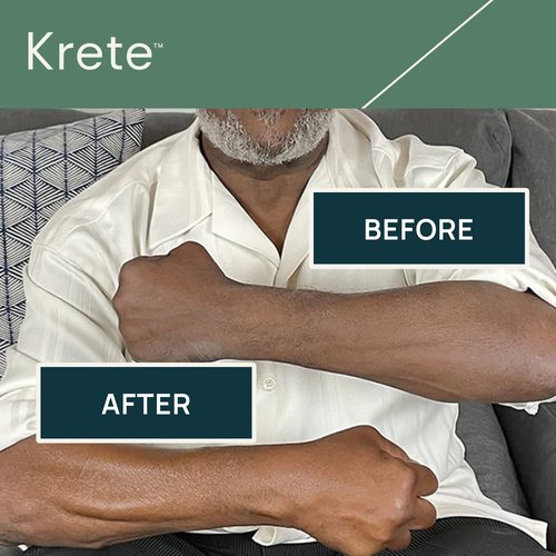 KRETE Hydrating Body Serum for Men - Moisturize, Smooth, Hydrate & Strengthen Your Skin In 30-Seconds, Oil-Free, All Skin Types, with Tripeptide-29 & Hyaluronic Acid