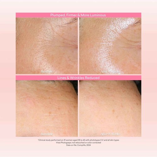 toty By Sofia Vergara - Reversa Retinol Photoage-Defying Serum - Anti-Aging to Reduce Lines and Wrinkles for Firm and Plump Skin - 0.5% Micro-Encapsulated Retinol, 5% Niacinamide, 2% NAG - 1.0 fl oz