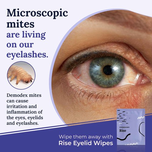 The Eyelid Hygiene Foundation | Self Heating Warm Compress for Eyes | Eye Wipes for Dry Eyes | Eye Compress for Puffy Eyes | Eye Mask for Fast Relief of Dry Eyes | Eyelid Wash Pads | Travel Friendly