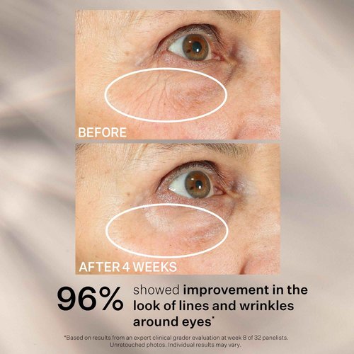 StriVectin Tighten and Lift Peptight 360 Degree Eye Serum with Tightening and Brightening Peptides for Wrinkles, Under Eye Bags and Puffiness, 1 fl. Oz