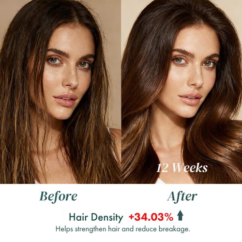 ALFHEIM Saw Palmetto Scalp Serum for Boost Follicle - Infused With Caffeine, Biotin for Thicker Hair - Balance Scalp, Rejuvenate Hair Follicles & Improve Hair Density - 1.69 fl oz + Serum Applicator