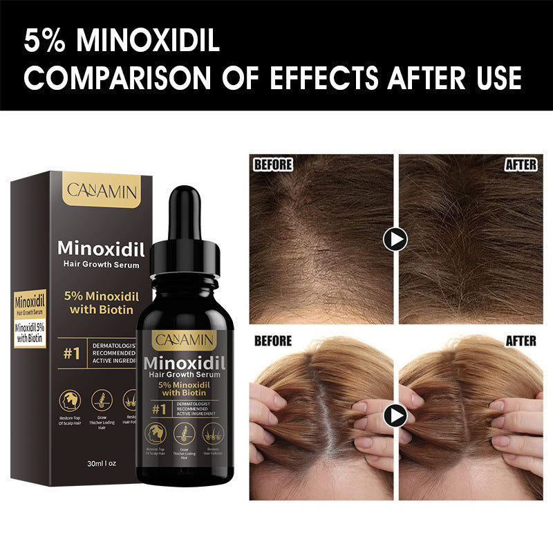 Minoxidil Hair Growth Serum 30ml
