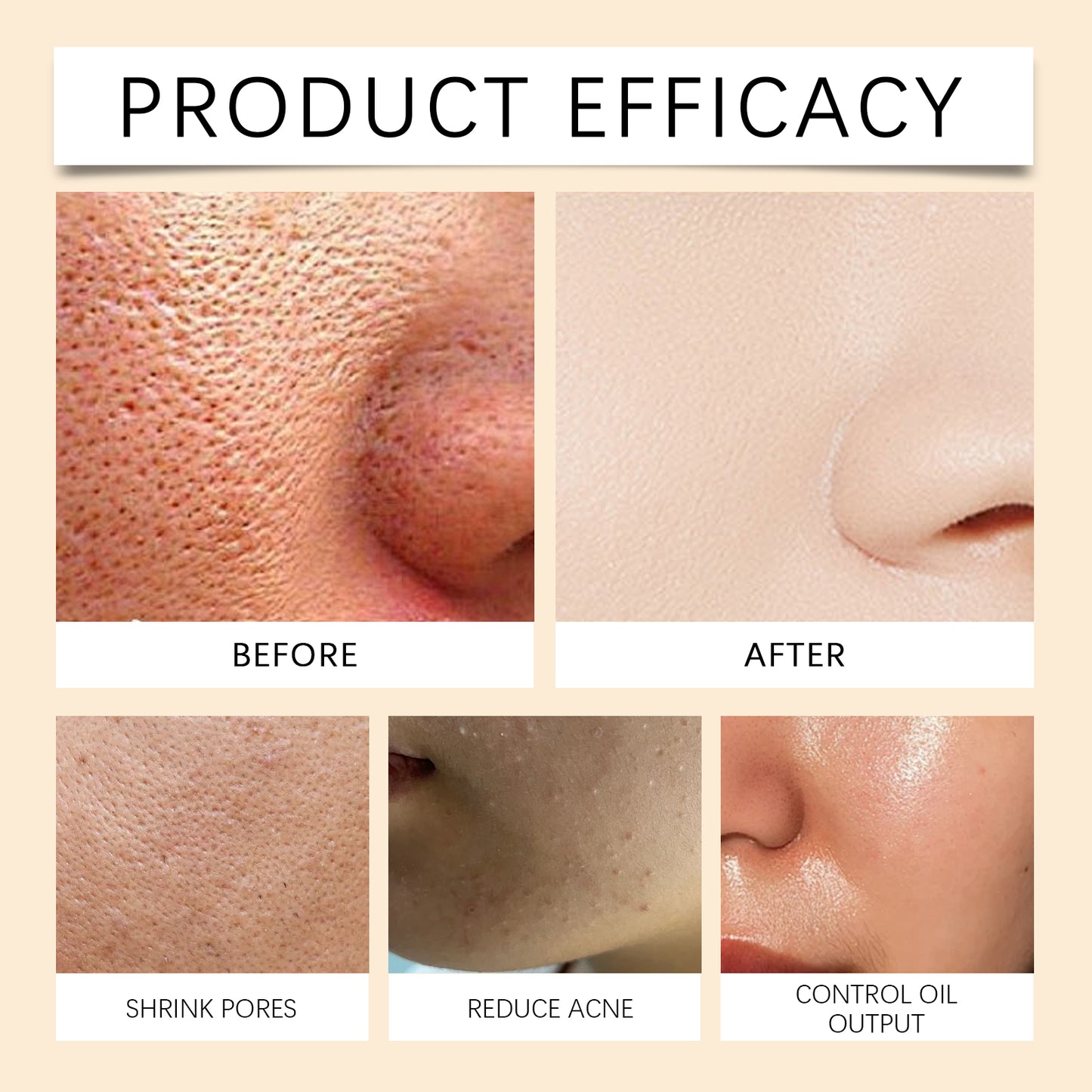 Turmeric Facial Cleanser with Built-in Brush Head for Acne Control