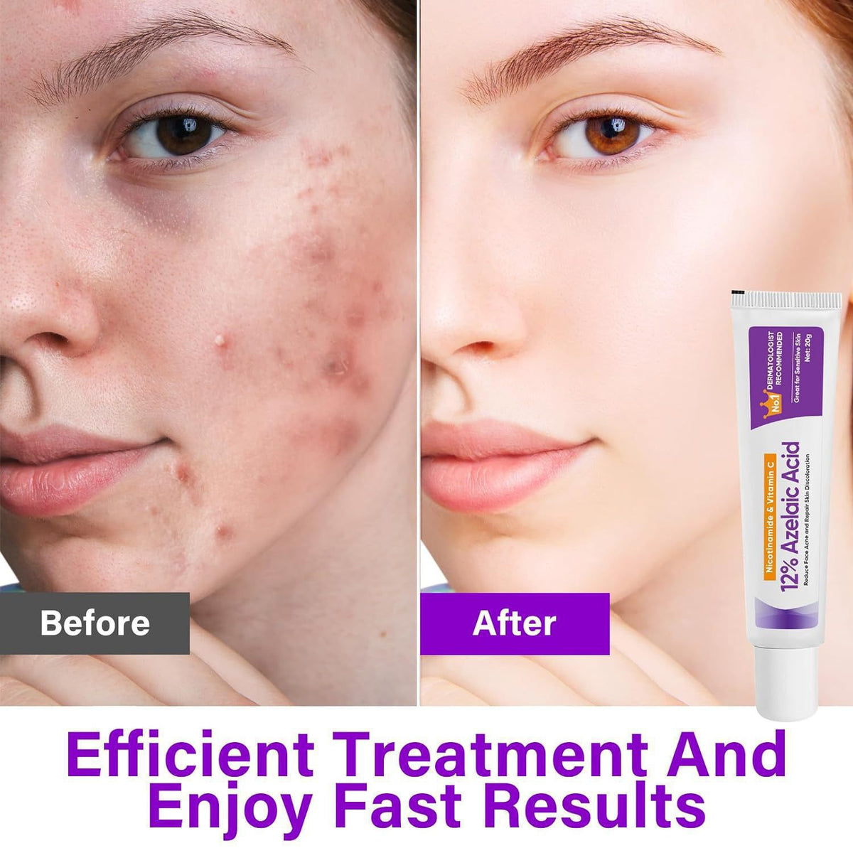 Lo Go Free 12percent Azelaic Acid