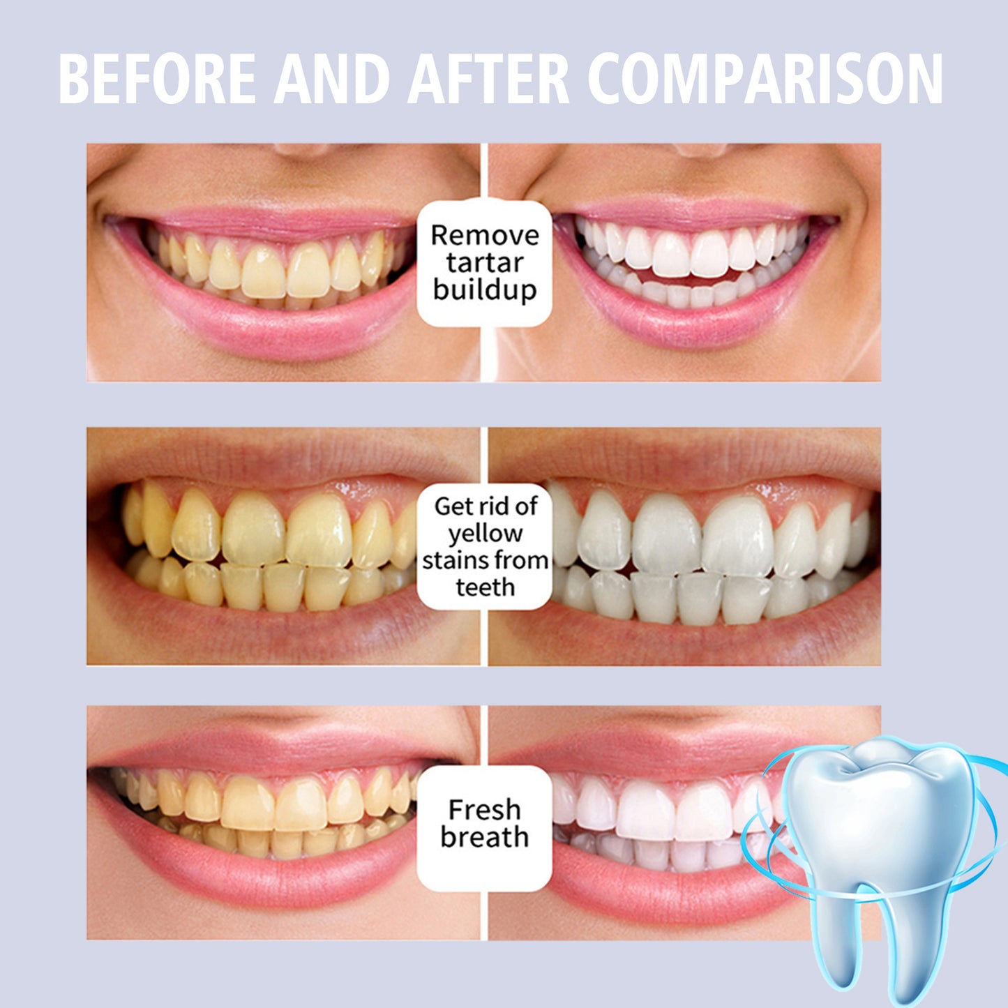Teeth Stain Removal and Gum Care Serum - 4ml Oral Health Treatment