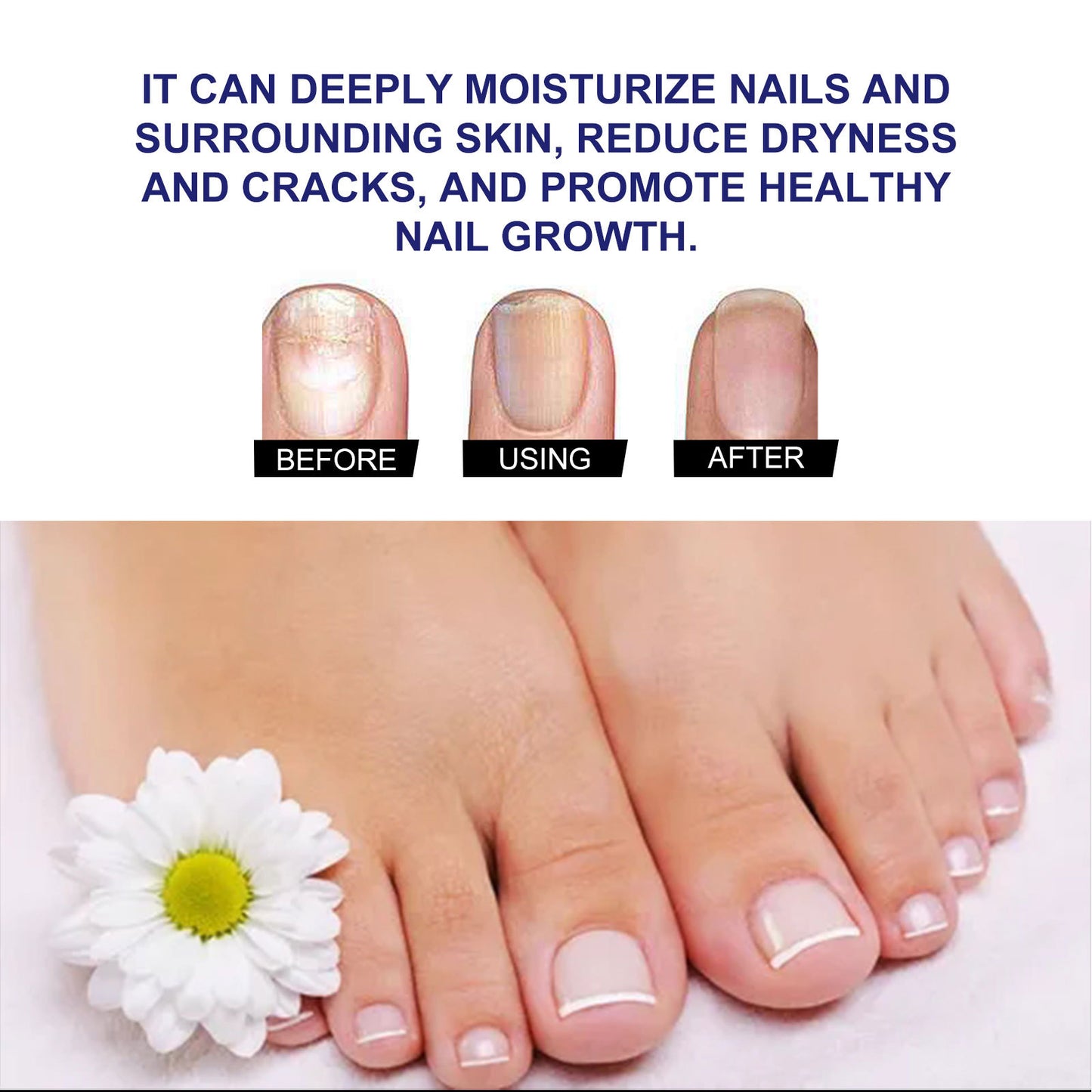 Nail Care Solution Repair Hand & Foot Softening Brightening 10ML