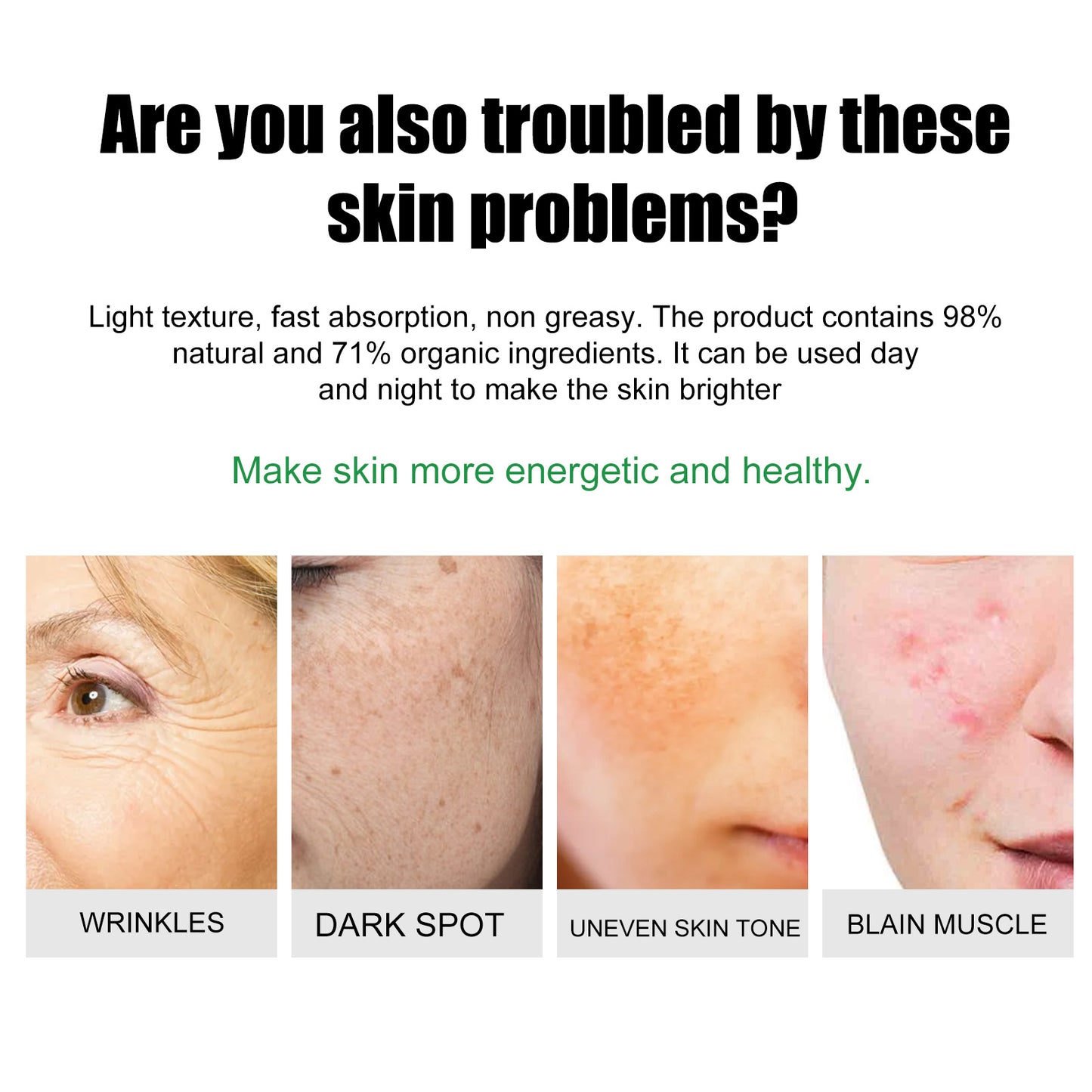 Niacinamide Acne & Blemish Removal Cream - Dark Spot Corrector & Skin Repair
