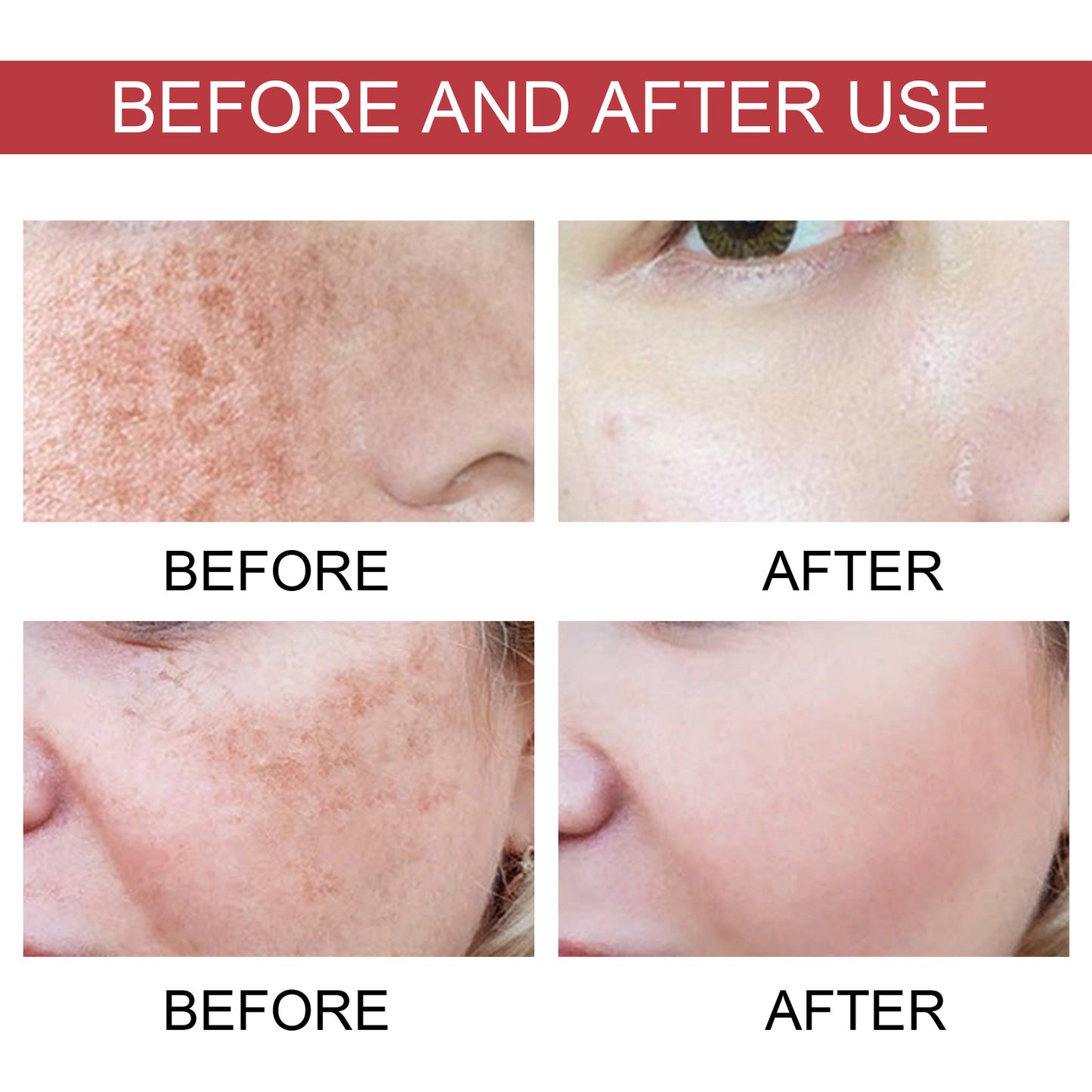 Dark Spot Repair Essence - Brightening & Moisturizing Face Serum