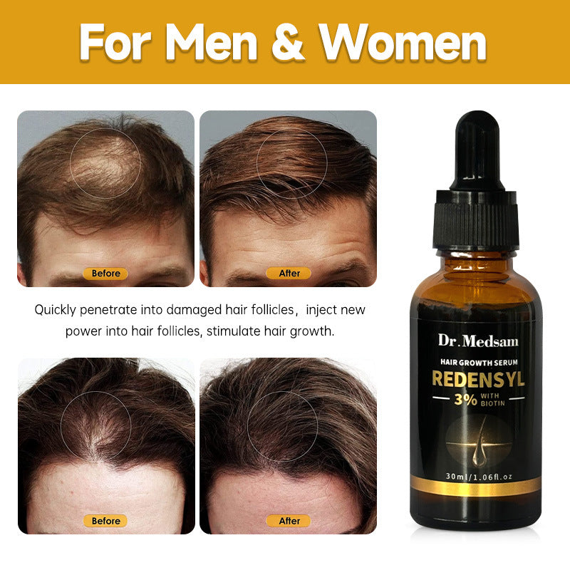 Biotin Rosemary Hair Growth Serum - 30ml