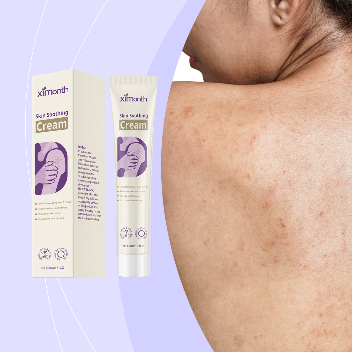 Skin Acne Herbal Smooth Rejuvenation External Use Care Cream